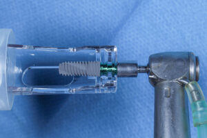 a dental implant with a drill attached to it