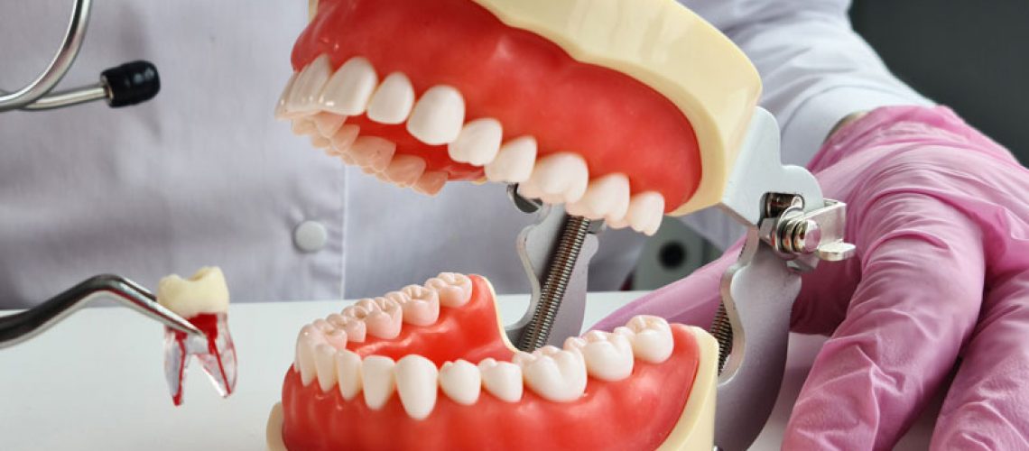 a full mouth model showcasing a single tooth extraction.