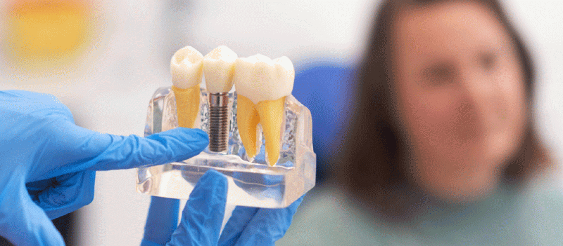 Close-up of dental model with implant. patient of dental clinic on blurred background. dentistry