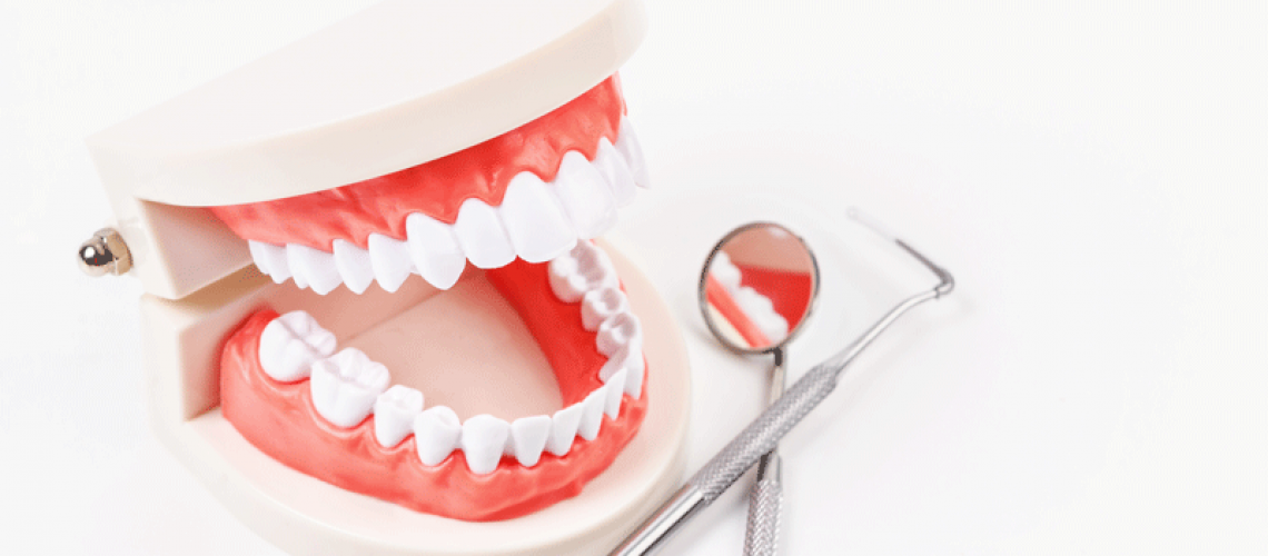 a full mouth dental implant model with dental tools.