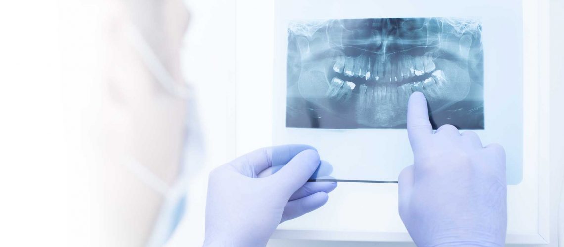 oral surgeon examining an x-ray