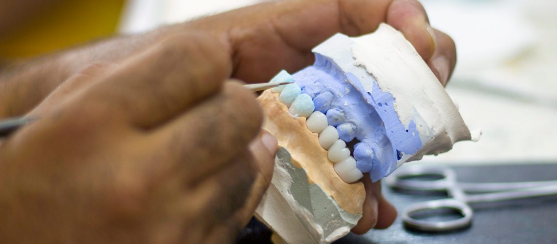 a dentist painting a full mouth all on x dental prosthetic implant model.